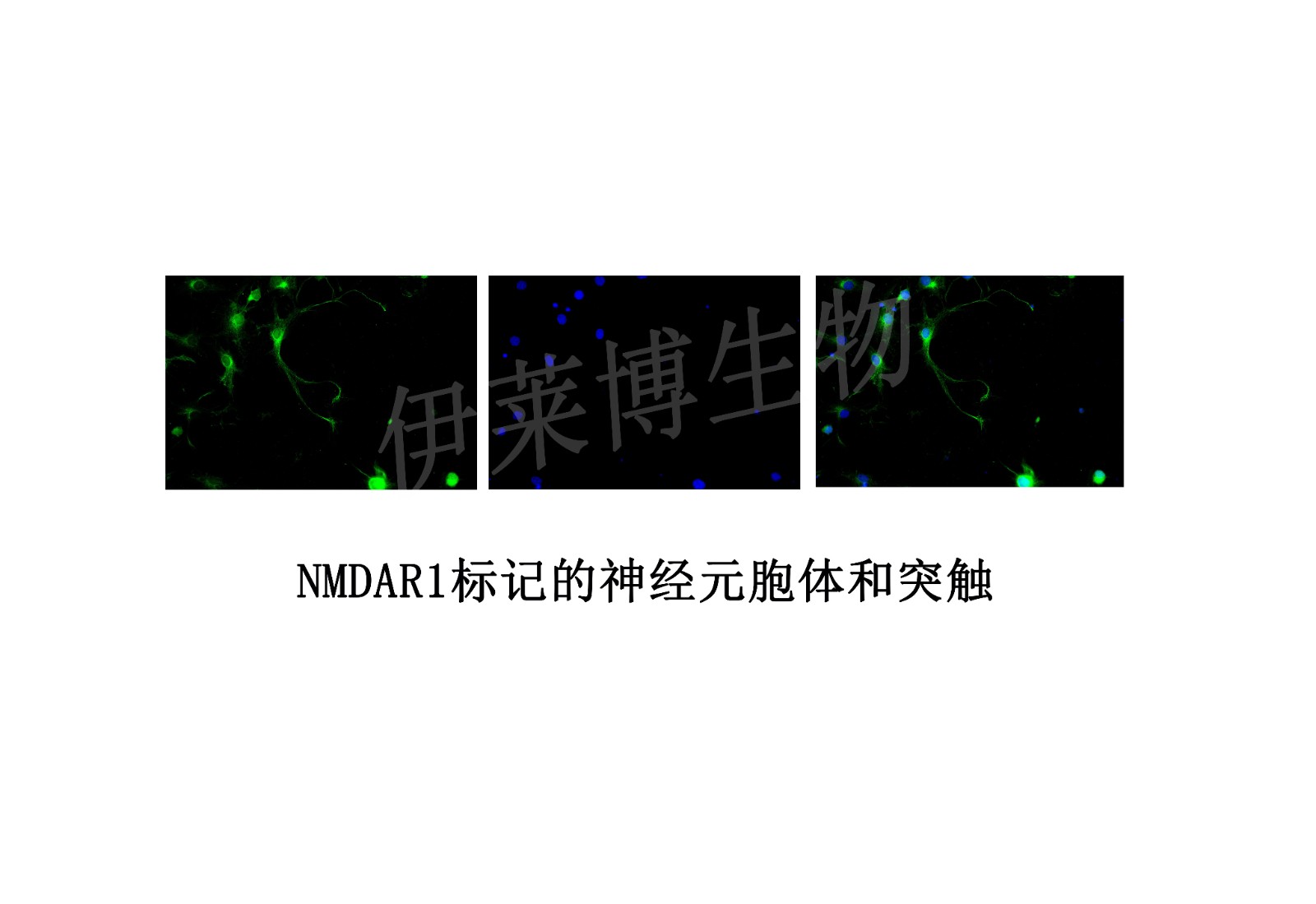 NMDAR1標記的神經元胞體和突觸.jpg